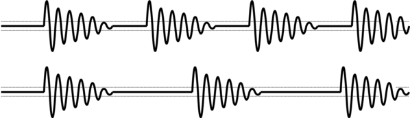 Erzielen Sie den gewünschten Gewebeeffekt, indem Sie den entsprechenden elektrochirurgischen Modus am VIO® 3 auswählen, wie z. B. endoCUT®, preciseSECT®, softCOAG oder dryCOAG, abgestimmt auf die Interventionstechnik.